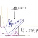 원 레그 카프 레이즈를 하시고 종아리에 알이생길까하시는분들보세요 이미지