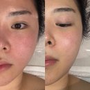 연신내 피부관리 뷰티인사이드, 근육부터 림프까지 동안관리 후기