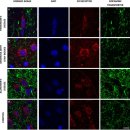 Re:Re: Mitochondrial dysfunction within the synapses of substantia nigra neurons in Parkinson’s disease 이미지