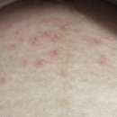 뷰티인하나 | 서울 구의 왁싱 임산부 21주차 인유어뷰티 브라질리언 후기