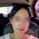 페이스 | 강남역 튠페이스 후기 (통증,다운타임, 가격)