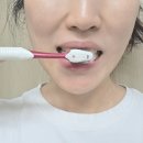 이니카 | 스케일링치약 알란토인 화이니카 치탄플러스 후기