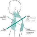 더숄더 어깨교정운동센터 | 라운드숄더, 거북목으로 인한 어깨통증 pt 교정후기 [안산 고잔동 재활운동]