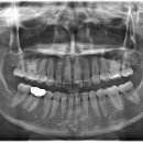 바른턱얼굴치과의원 이미지