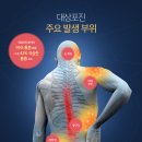 질병 &#34;대상포진 Herpes zoster&#34; 이미지