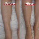 미석 | [잠실왁싱] 민감피부도 걱정없는 슈가링 다리왁싱 후기 송파왁싱 추천, SHE IN US 한국메디뷰티