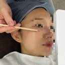 [원주/반곡동/에스테틱] 원주슈퍼젝션 전문 ‘제이앤스킨케어’