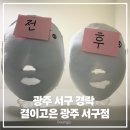 고은스킨&바디 - 성남시 수정구 | [광주서구 피부관리 추천] 결이고은 슬리밍바디관리 후기 – 1회만에 확실히 다름