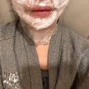 페이스필터의원 | 📌 내돈내산) 목필러 후기/ 목필러 리터치 상세 후기 (만족도 100%/병원 고르는방법)