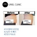 바디라인업