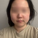 피부관리 전문 결이고은 노원점 윤곽관리 스페셜작은얼굴관리 후기