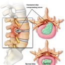 라룬 리픽스 클리닉(La Lune ReFix Clinique) | (La Lune ReFix Clinique)라룬 리픽스 클리닉의 짧은 요통이야기