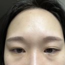 바이어간츠코리아 | 모공축소에 좋은 바이어간츠 레티날크림 사용후기