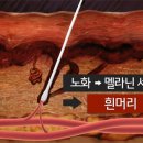 머리 지지는 날