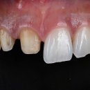 뿌리치과기공소 이미지