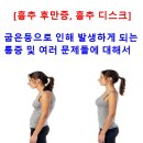 흉추후만(굽은등)으로 발생하는 흉추 디스크 통증