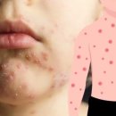 이로움메디컬 이미지