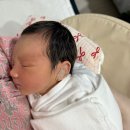 태상에이스(주) | 5개월 아기 단두 두상 교정 헬멧 한달차 후기_에이스밴드 강남