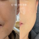 파주운정피부관리 서연뷰티 수분 탄력 모든걸 되찾다!!