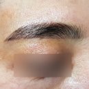 수지로3R-1 | 12. 김포 장기동 반영구 눈썹 잘하는곳. 뷰티홀릭 (콤보:엠보+수지3R)