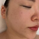 스톤베니어 이미지