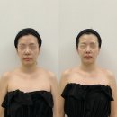 신반포로47길 9-3 | 강남 웨딩관리 비대칭 거북목 잡는 '신의손' 원장님 어나더핸드...논현 피부관리 진짜 강추! (후기사진 有)