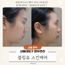 서울대입구 피부관리 블링유 스킨케어, 웨딩준비 이중턱 탄력리프팅