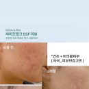 달아오름