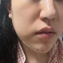 [토너 추천] 열감 피부에 효과 좋은 &#39;하이드라 베리어 시카 에센스 토너&#39;! 솔직 후기 &amp; 효과