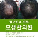 모생한의원 네이버블로그