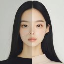 우유빛의원 | 우유빛의원 - 팔자주름 리무버 찐후기