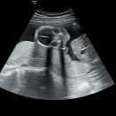 효성요양병원 화장실 | 남해 태교여행 - 이제 남해 숙박후기, 임신 19주차 정기검진