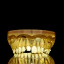 센트릭치과기공소 이미지