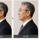 가윤메디텍 | 결혼을 앞두고 가장 신경 쓰였던 건 사실 얼굴선이었어요. 예비신부의 솔직 후기