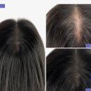 탈모왕 광주점 이미지