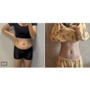 람스네일 - 북구 첨단연신로108번길 128 | 복부 무한람스 6주차 후기 부작용과 가격은