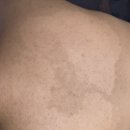 드림21 | 천안 두정동 피부관리 등드림 재생관리 후기 오마주21 스킨케어