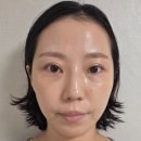 신논현약국 | 신논현역피부과 릴리쥬 시술후기 리쥬란힐러+릴리이드 물광주사로 건조한 피부 개선!