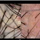 뉴헤어모발성형외과의원 이미지