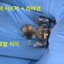 신흥환경 | 어금니 충치 치료 | 신경치료 없이 당일 완성! 신흥역 치과 레진 빌드업 후기