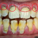 스마일러치과의원 이미지