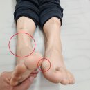 안동체형교정 라파엘체형교정에서 바디 체크후기