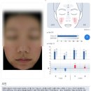 (주)호텔스카이파크 킹스타운동대문 | 동대문피부관리 앤올리브 에스테틱 여드름압출 피부관리 후기