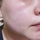 수분폭탄세럼추천 코리아나 세디르 턴오버 에너지 앰플 크림