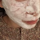 수원시원한의원 | 수원; 연세브이의원 영통점_내돈내산 얼굴 원데이 올킬(검버섯/점/사마귀 제거)