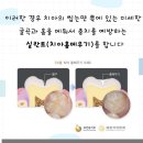 현대제철 문화센터 치과의원 네이버블로그