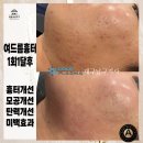 아미뷰티