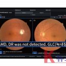 인천광역시복싱협회, 전국생활복싱대회에 국내 최초 AI 안저검사 도입… 선수 건강관리 혁신 이미지