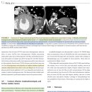 개와 고양이의 흉강 및 복강 carcinomatosis와 sarcomatosis의 임상적, CT, 그리고 초음파 특징들 이미지