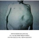 똥을 못싸는 병.jpg 이미지